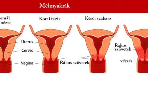 Tehetünk a megelőzésért!