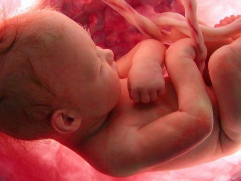 Orvosi bravúr: édesanyja méhében operálták meg a születendő baba gerincét