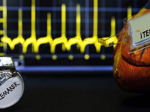 A szívverés energiájával működő pacemakert fejlesztettek ki