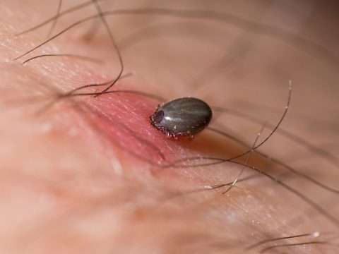 Parazitológus: a kullancsot minél hamarabb el kell távolítani