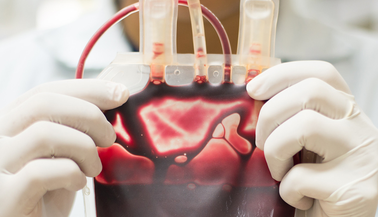 Új találmány a mesterséges vér, bármilyen vércsoportú ember kaphatja
