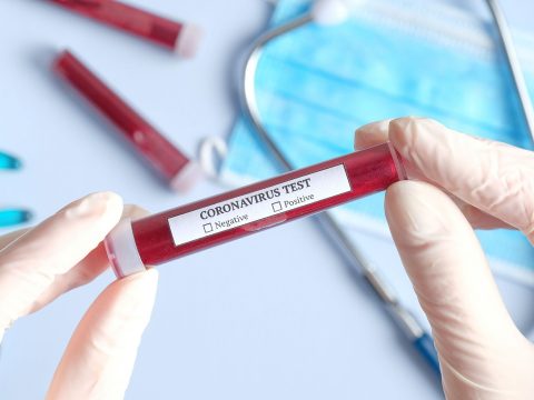 2 millió koronavírus-tesztet küld Romániának egy dél-koreai cég