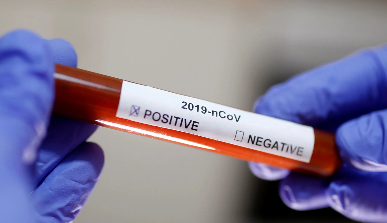 A szentgyörgyi kórház további négy alkalmazottja fertőzött koronavírussal