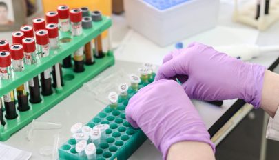 Kutatás: az antitestek mennyisége gyorsan csökken a fertőzést követően