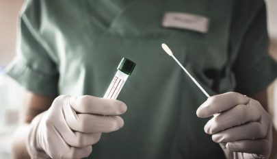 4841 új koronavírusos megbetegedést jelentettek 31.592 teszt feldolgozása nyomán