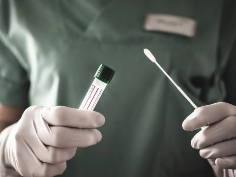 19.649 új koronavírusos megbetegedést jelentettek, 82 ezer teszt elvégzése nyomán