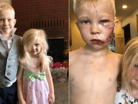 Kutyatámadástól mentette meg kishúgát a hatéves fiú
