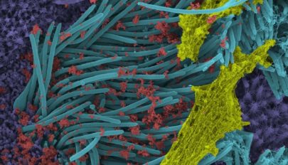 Látványos képen ábrázolták, ahogy egy csapat koronavírus megrohamozza a tüdősejteket
