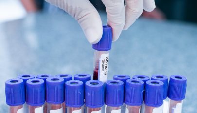 3350 új koronavírusos megbetegedést jelentettek 12.234 teszt feldolgozása nyomán