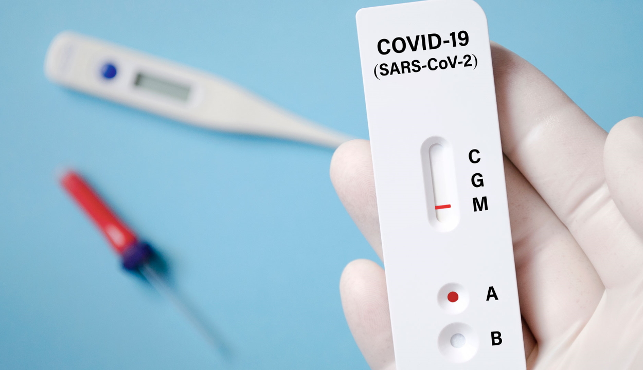 94,5 és 200 lej között váltakozik klinikánként a koronavírus antitest tesztek ára