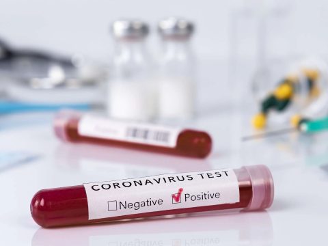 5158 új koronavírusos megbetegedést jelentettek 25.788 teszt feldolgozása nyomán