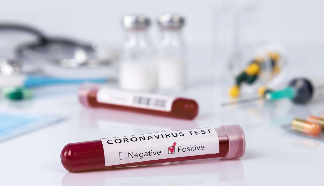 1709 koronavírusos megbetegedést jelentettek az elmúlt 24 órában