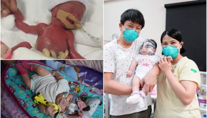 Egy év után hazavihették szülei a világ legkisebb újszülöttjeként világra jött babát
