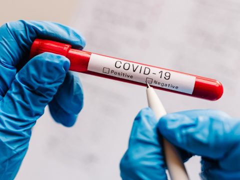 2320 koronavírusos megbetegedést jelentettek az elmúlt 24 órában