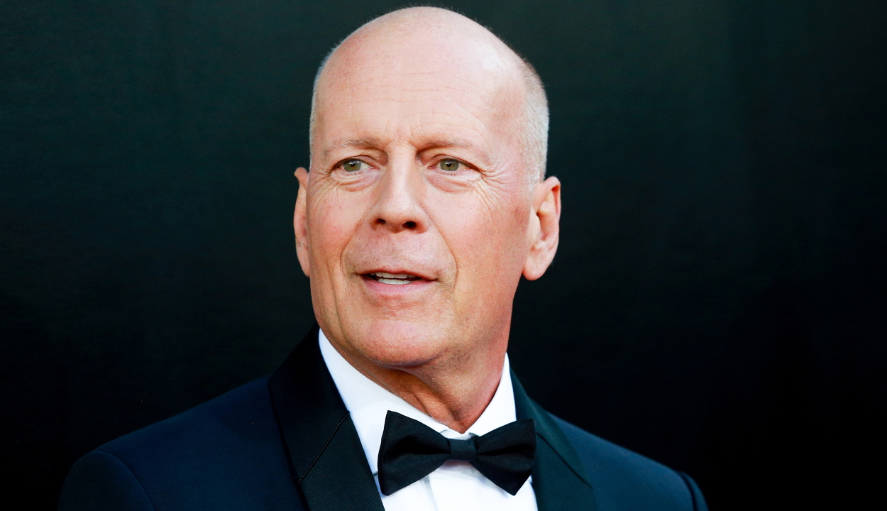 Bruce Willis egészségi állapota miatt felhagy a színészi pályával