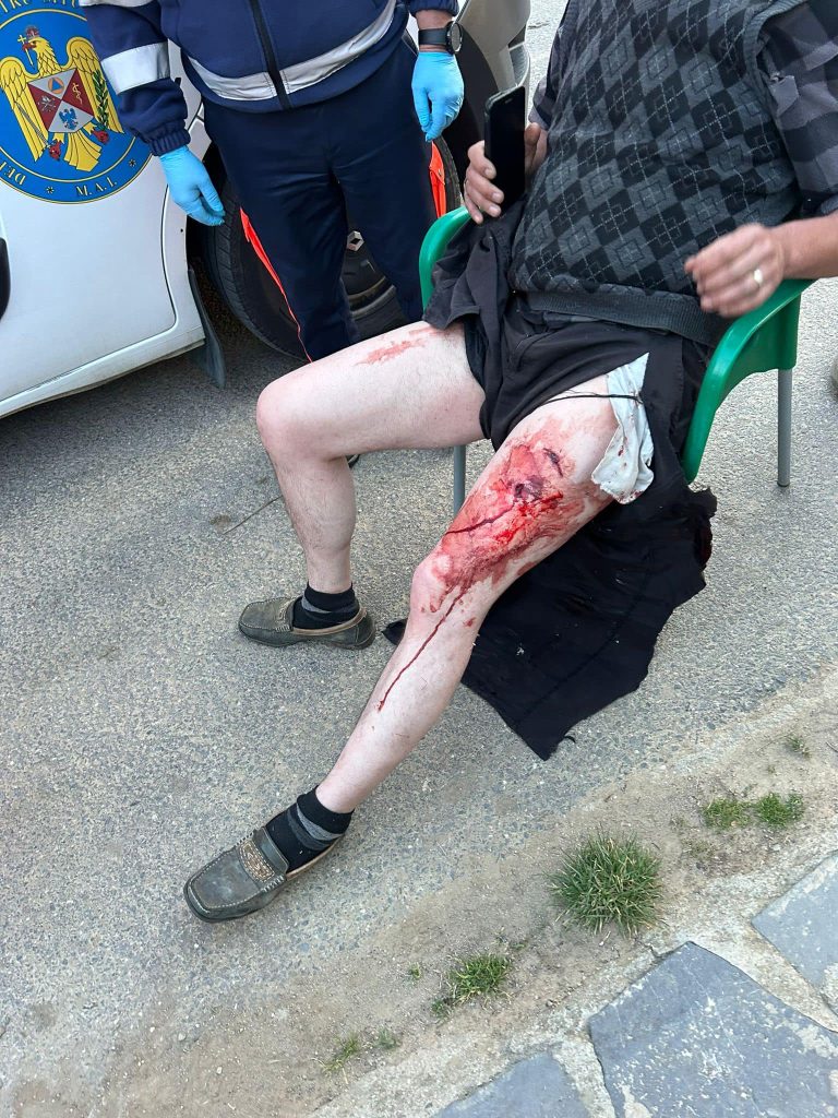 A lábán érte sérülés az áldozatot. Fotó: Bölön Önkormányzata